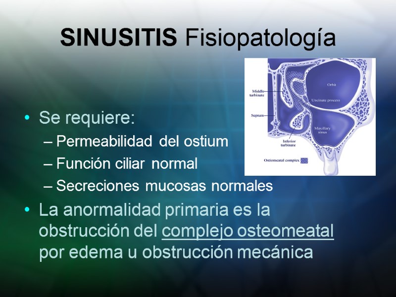 SINUSITIS Fisiopatología  Se requiere: Permeabilidad del ostium Función ciliar normal Secreciones mucosas normales